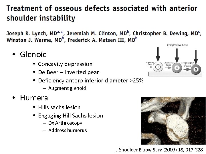  • Glenoid • Concavity depression • De Beer – Inverted pear • Deficiency