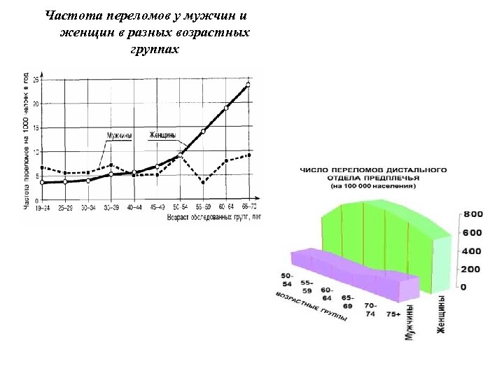 Частота переломов у мужчин и женщин в разных возрастных группах 