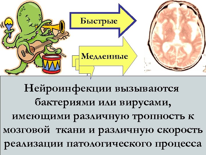 Быстрые Медленные Нейроинфекции вызываются бактериями или вирусами, имеющими различную тропность к мозговой ткани и