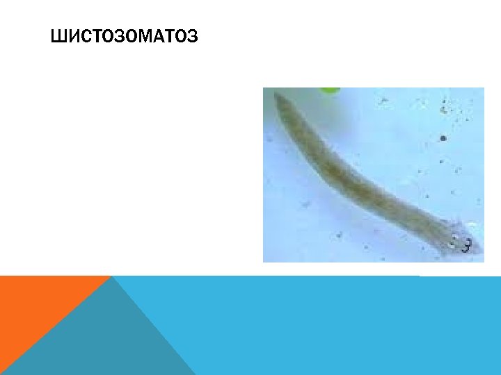 ШИСТОЗОМАТОЗ 