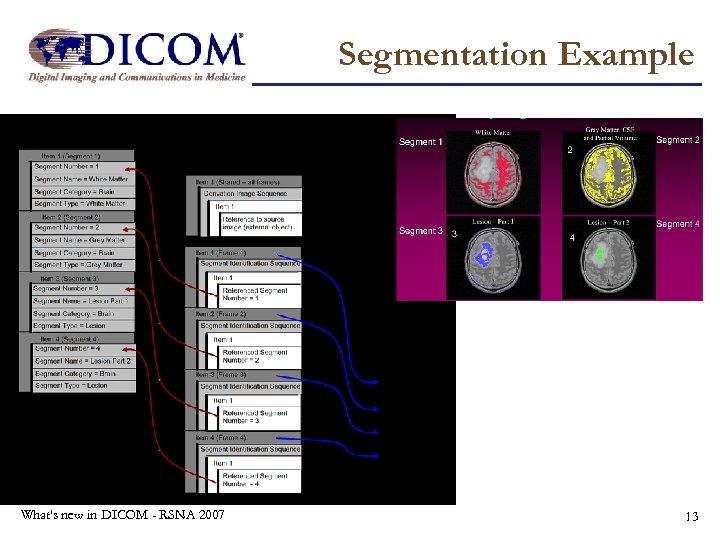 Segmentation Example What's new in DICOM - RSNA 2007 13 
