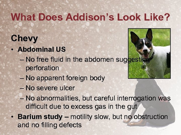 What Does Addison’s Look Like? Chevy • Abdominal US – No free fluid in