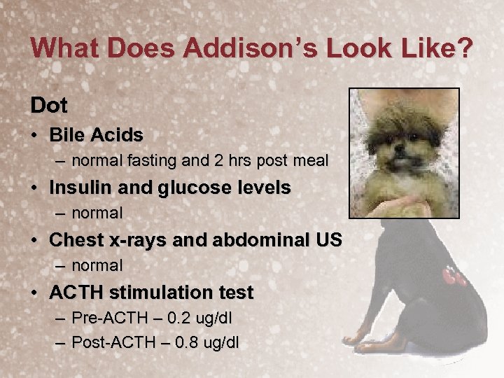 What Does Addison’s Look Like? Dot • Bile Acids – normal fasting and 2