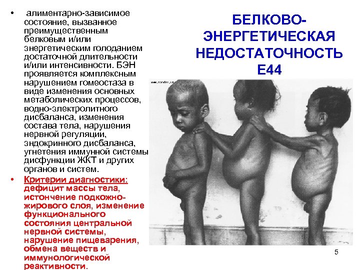  • • алиментарно-зависимое состояние, вызванное преимущественным белковым и/или энергетическим голоданием достаточной длительности и/или