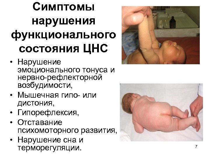 Симптомы нарушения функционального состояния ЦНС • Нарушение эмоционального тонуса и нервно-рефлекторной возбудимости, • Мышечная