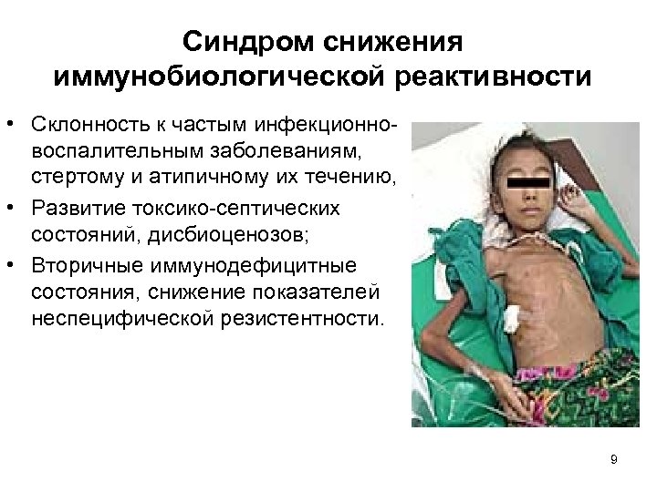 Синдром снижения иммунобиологической реактивности • Склонность к частым инфекционновоспалительным заболеваниям, стертому и атипичному их
