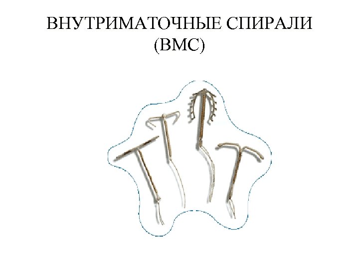 ВНУТРИМАТОЧНЫЕ СПИРАЛИ (ВМС) 