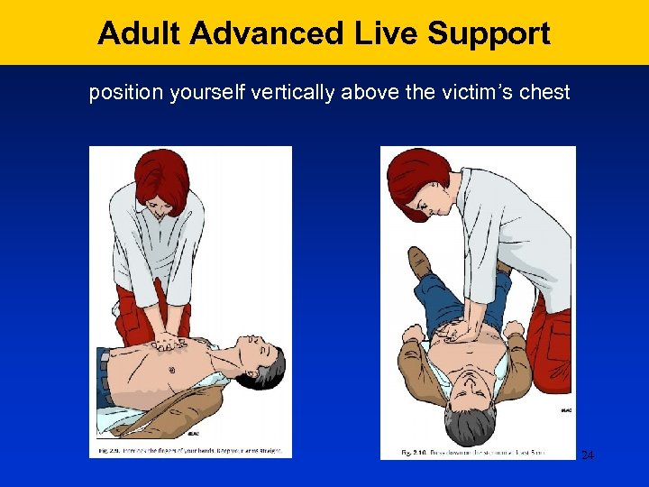 Adult Advanced Live Support position yourself vertically above the victim’s chest 24 