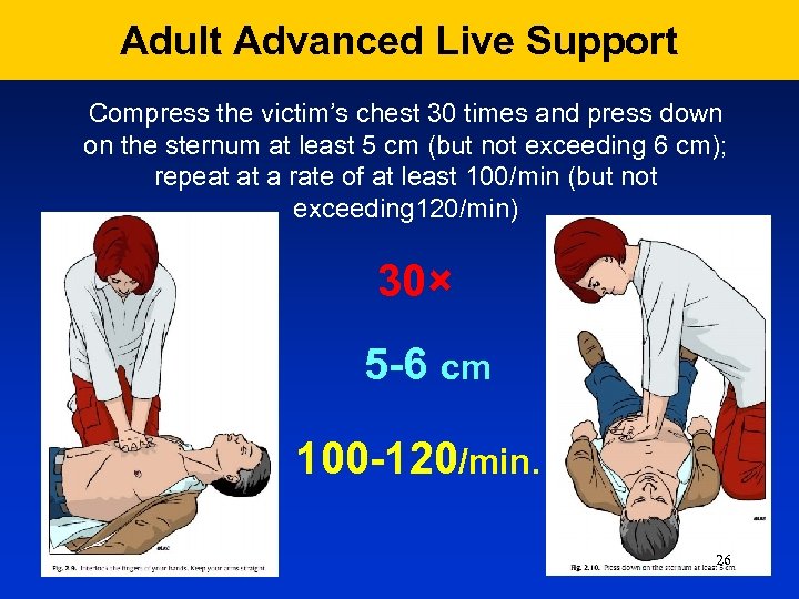 Adult Advanced Live Support Compress the victim’s chest 30 times and press down on