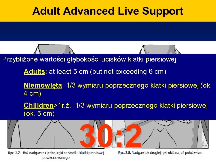 Adult Advanced Live Support Przybliżone wartości głębokości ucisków klatki piersiowej: Adults: at least 5