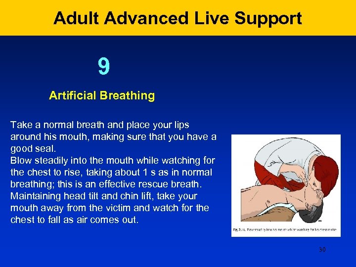 Adult Advanced Live Support 9 Artificial Breathing Take a normal breath and place your