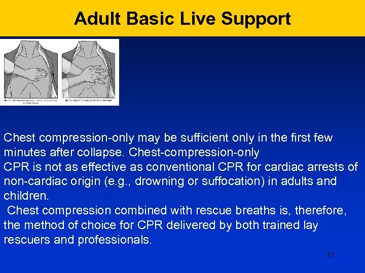 Adult Basic Live Support Chest compression-only may be sufficient only in the first few