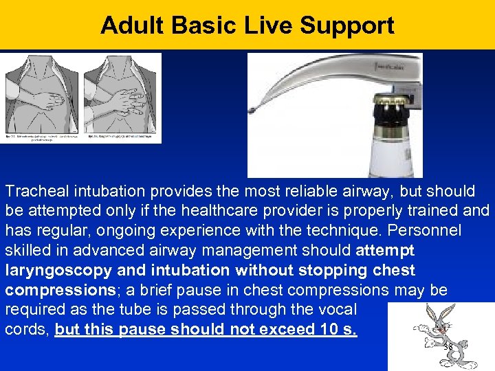 Adult Basic Live Support Tracheal intubation provides the most reliable airway, but should be