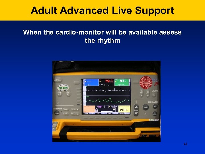 Adult Advanced Live Support When the cardio-monitor will be available assess the rhythm 41