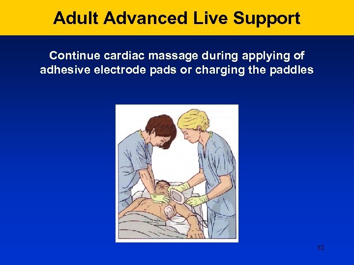 Adult Advanced Live Support Continue cardiac massage during applying of adhesive electrode pads or