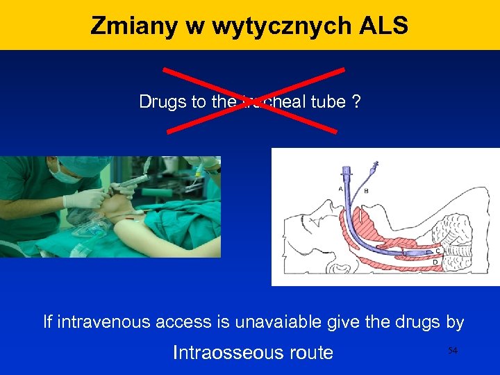 Zmiany w wytycznych ALS Drugs to the tracheal tube ? If intravenous access is