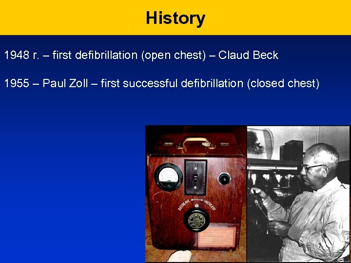 History 1948 r. – first defibrillation (open chest) – Claud Beck 1955 – Paul