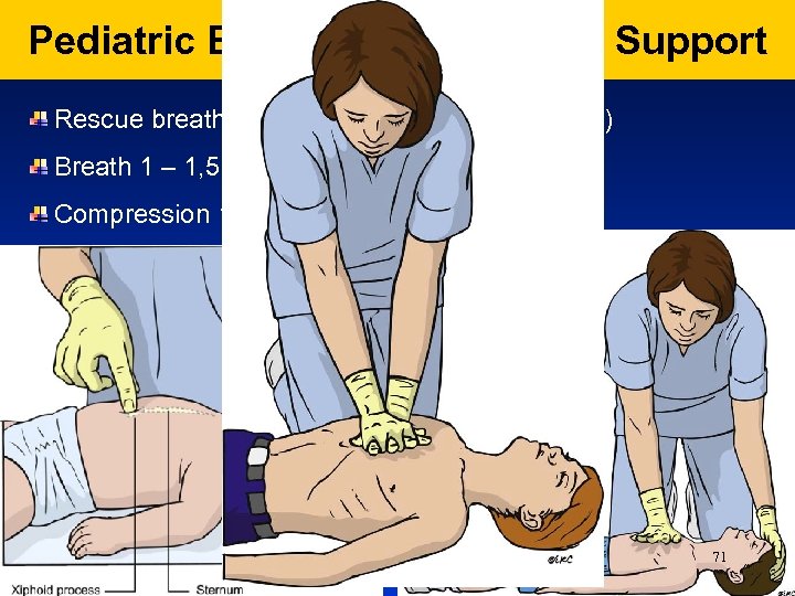 Pediatric Basic/Advanced Live Support Rescue breath (5 breaths, następnie CPR 15: 2) Breath 1