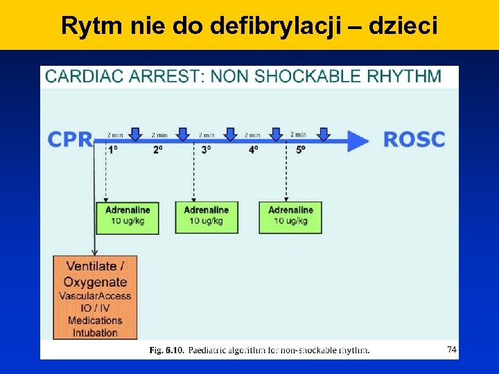 Rytm nie do defibrylacji – dzieci 74 