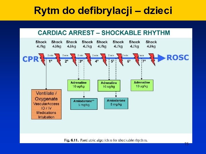 Rytm do defibrylacji – dzieci 75 