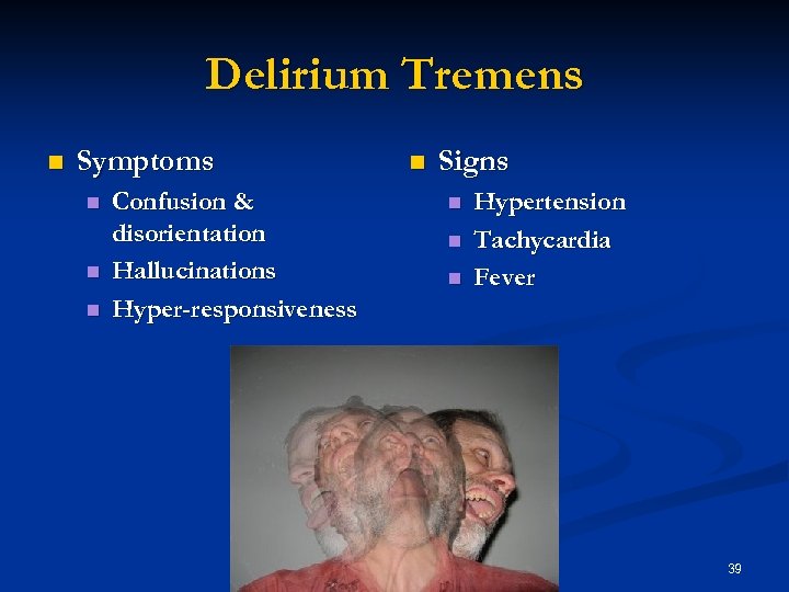 Delirium Tremens n Symptoms n n n Confusion & disorientation Hallucinations Hyper-responsiveness n Signs