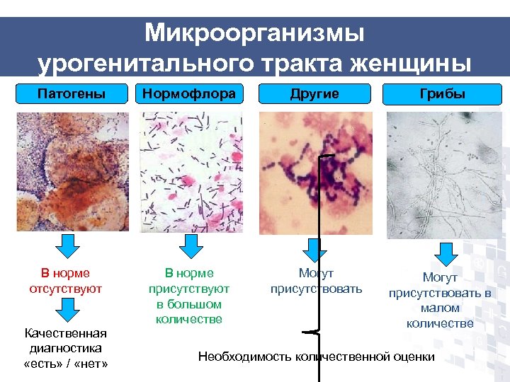 Исследование микрофлоры урогенитального. Микроорганизмы урогенитального тракта. Микрофлора урогенитального тракта. Заболевания урогенитального тракта. Микрофлора мочеполового тракта.