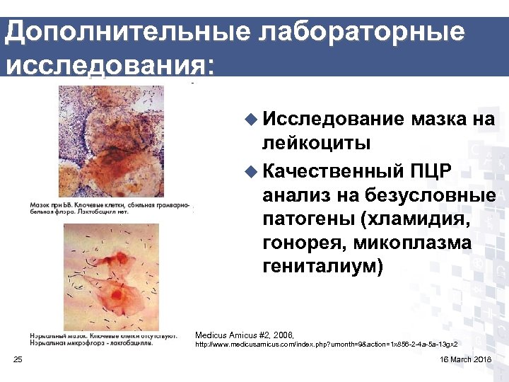 Дополнительные лабораторные исследования: u Исследование мазка на лейкоциты u Качественный ПЦР анализ на безусловные