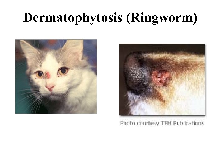 Dermatophytosis (Ringworm) 