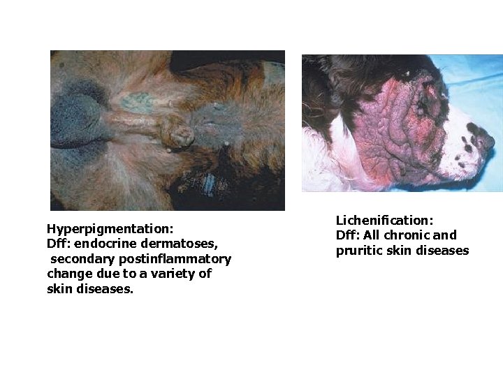 Hyperpigmentation: Dff: endocrine dermatoses, secondary postinflammatory change due to a variety of skin diseases.