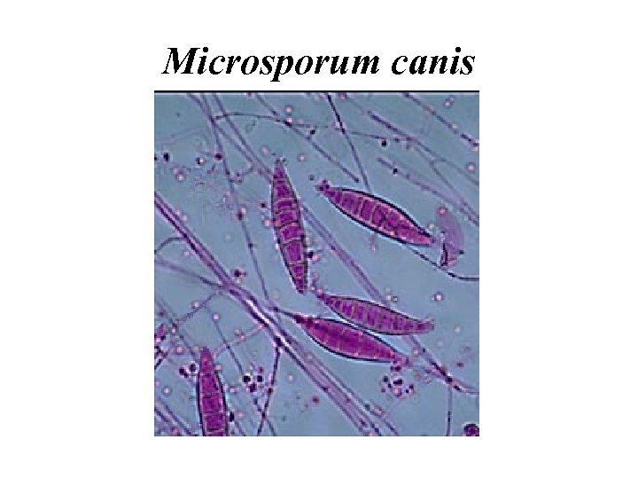 Microsporum canis 