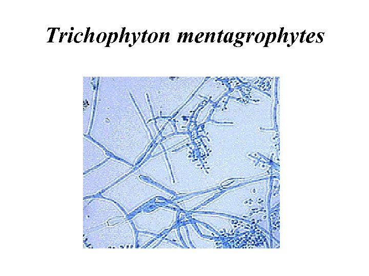 Trichophyton mentagrophytes 