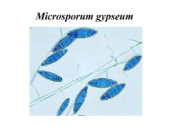 Microsporum gypseum 