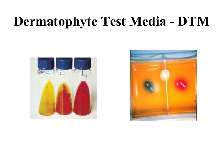 Dermatophyte Test Media - DTM 