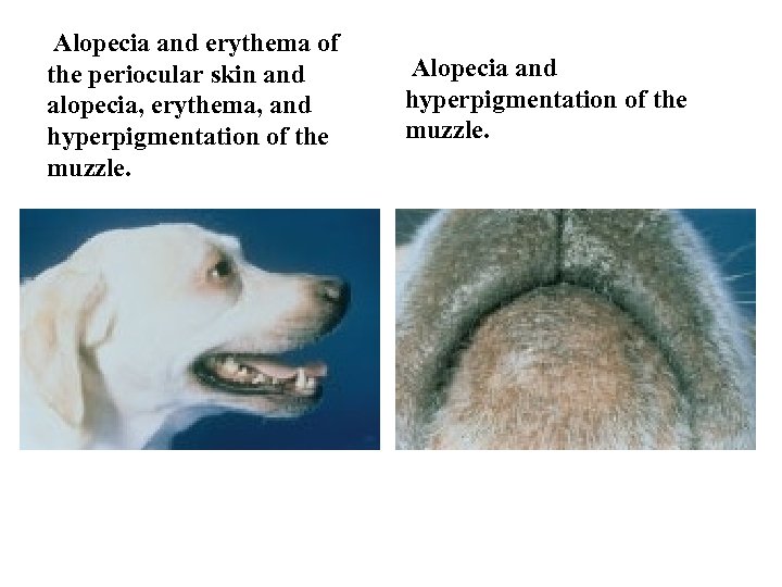 Alopecia and erythema of the periocular skin and alopecia, erythema, and hyperpigmentation of the