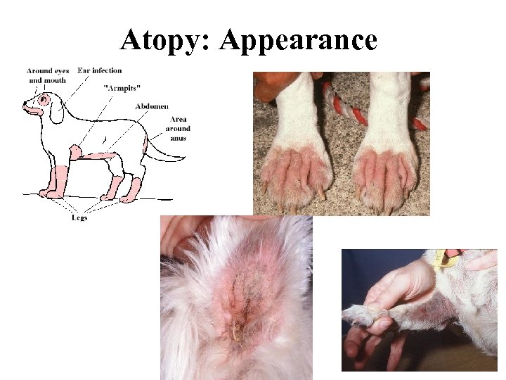 Atopy: Appearance 