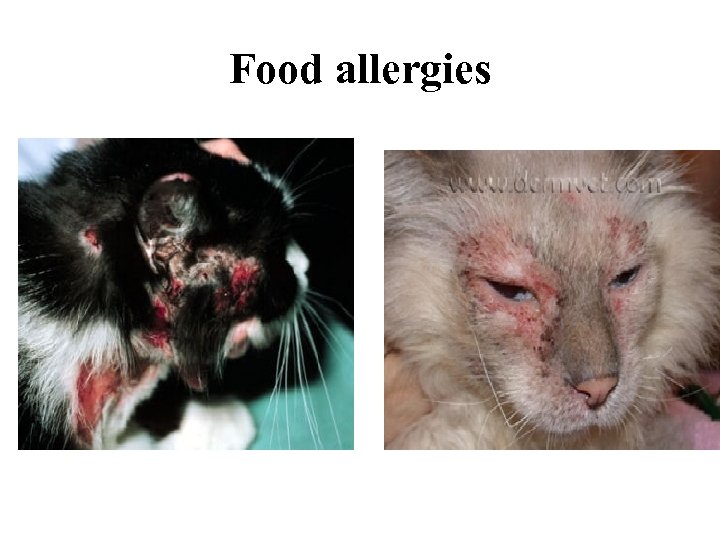 Food allergies 