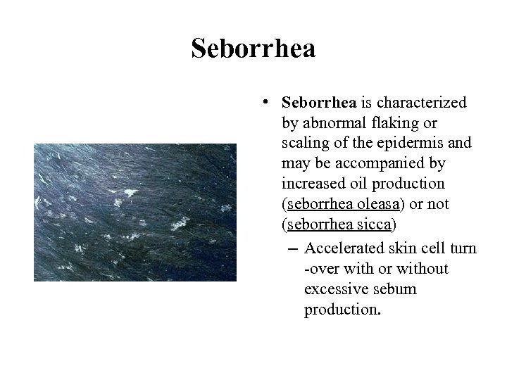 Seborrhea • Seborrhea is characterized by abnormal flaking or scaling of the epidermis and