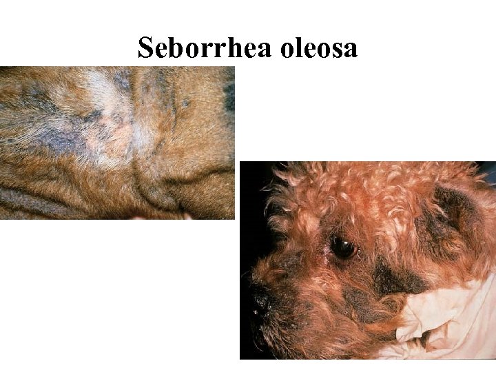 Seborrhea oleosa 