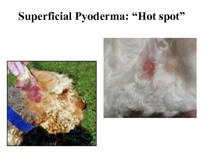 Superficial Pyoderma: “Hot spot” 