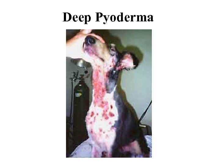 Deep Pyoderma 