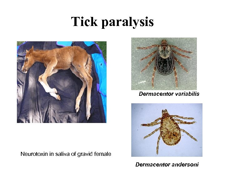 Tick paralysis Dermacentor variabilis Neurotoxin in saliva of gravid female Dermacentor andersoni 