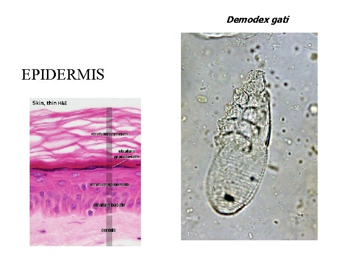 Demodex gati EPIDERMIS 