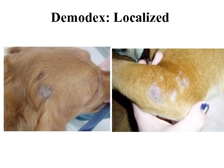 Demodex: Localized 