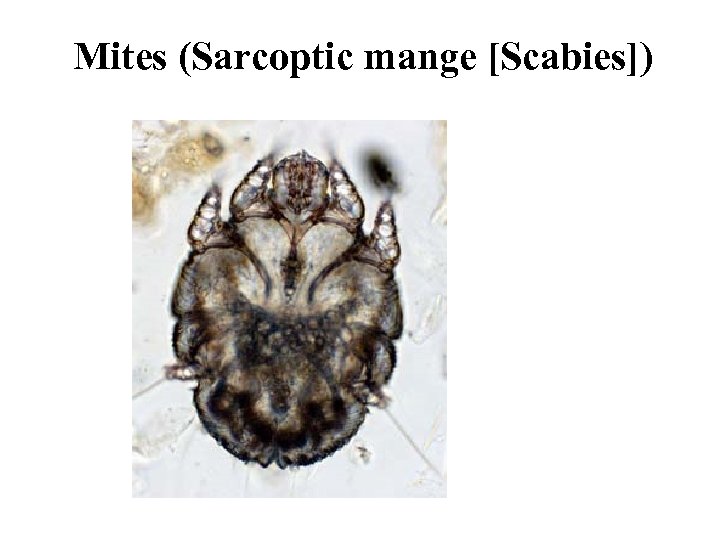 Mites (Sarcoptic mange [Scabies]) 