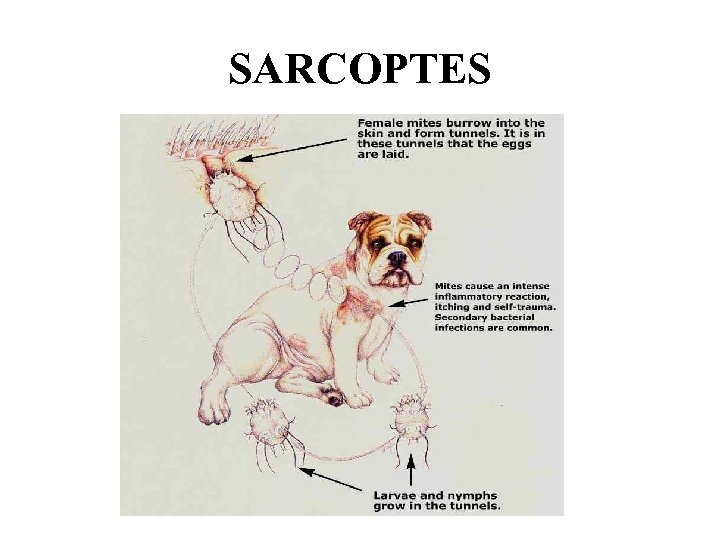 SARCOPTES 