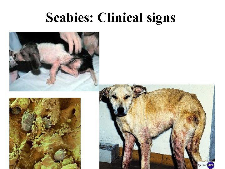 Scabies: Clinical signs 