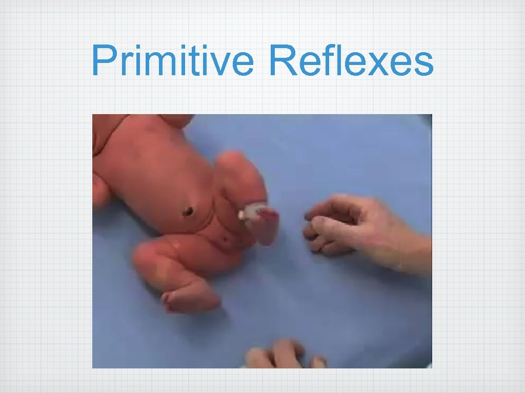 Primitive Reflexes 
