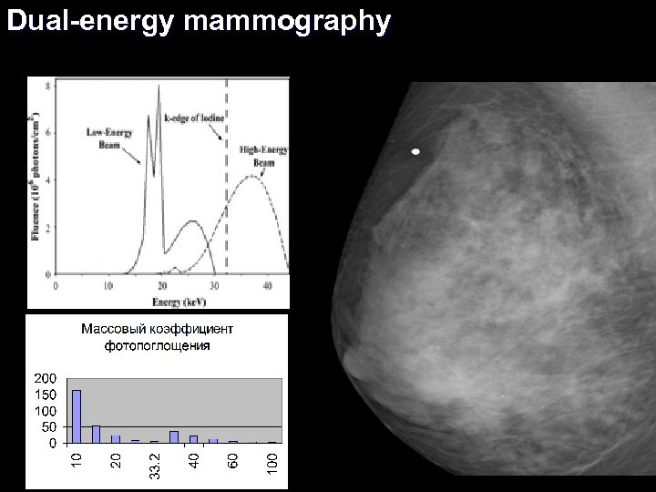 Dual-energy mammography 