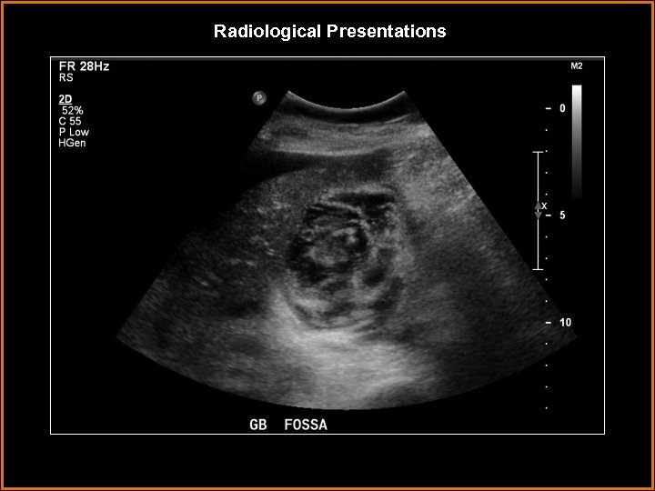 Radiological Presentations 