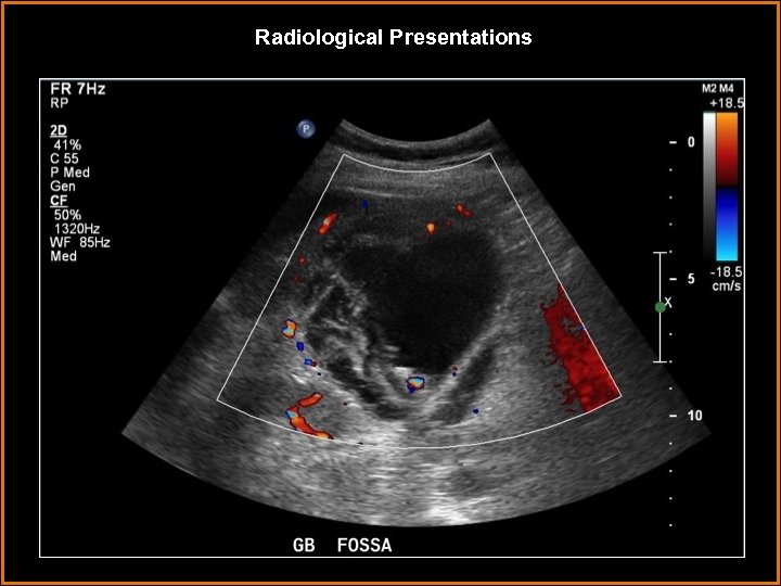 Radiological Presentations 